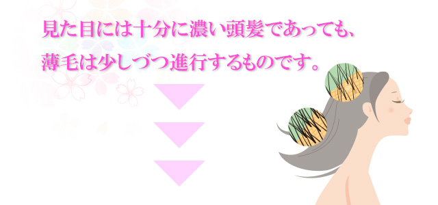 見た目には十分に濃い頭髪であっても、薄毛は少しづつ進行するものです。