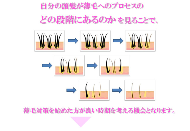 自分の頭髪が薄毛へのプロセスのどの段階にあるのかを見ることで、薄毛対策を始めた方が良い時期を考える機会となります。